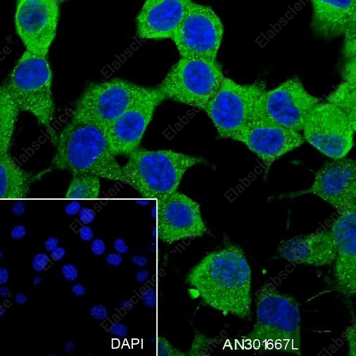Recombinant STIP1/STI1 Monoclonal Antibody - 5