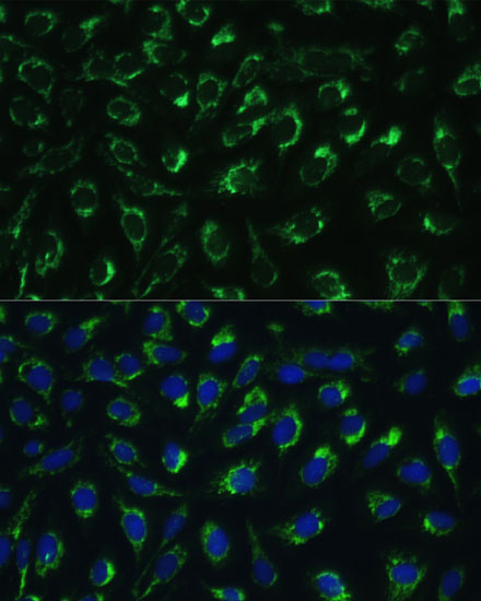 Immunofluorescence analysis of U-2 OS cells using MTIF2 Polyclonal Antibody at dilution of  1:100 (40x lens). Blue: DAPI for nuclear staining.