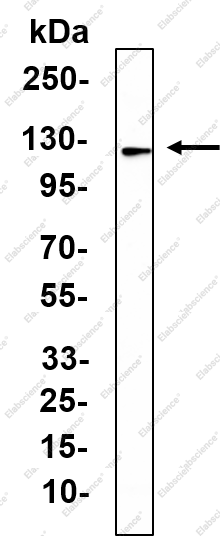 Recombinant Progesterone Receptor(PR) Monoclonal Antibody - 2