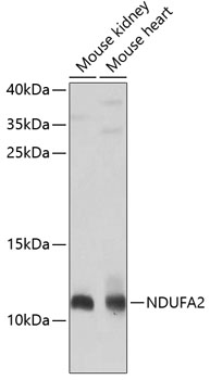 Western blot analysis of extracts of various cell lines using NDUFA2 Polyclonal Antibody at 1:1000 dilution.