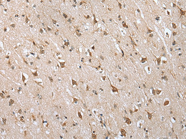 Immunohistochemistry of paraffin-embedded Human brain tissue  using HIF1A Polyclonal Antibody at dilution of 1:45(?200)