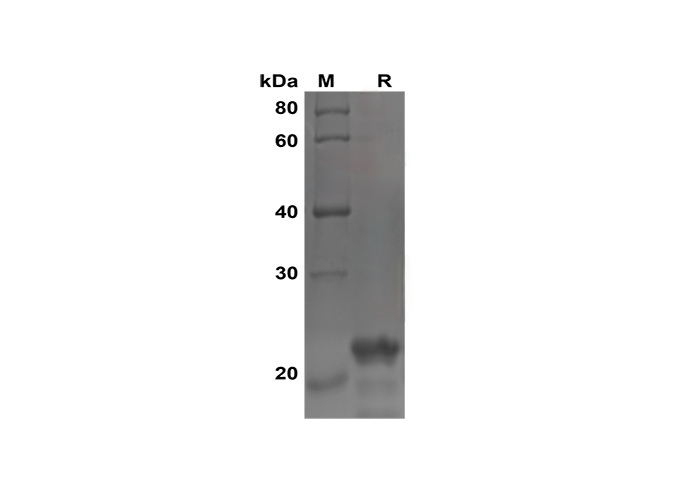 Recombinant Human G-CSF Protein(Trx Tag)-产品推荐-1