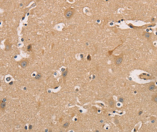 Immunohistochemistry of paraffin-embedded Human brain tissue using CDK11A/B Polyclonal Antibody at dilution 1:50