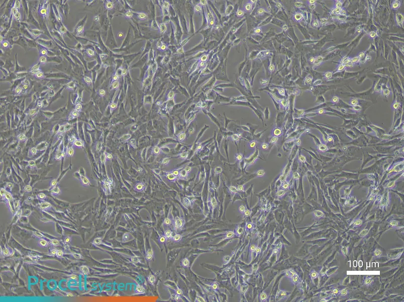 Rat Tracheal Fibroblast Complete MediumRat Tracheal Fibroblast Complete Medium - 1