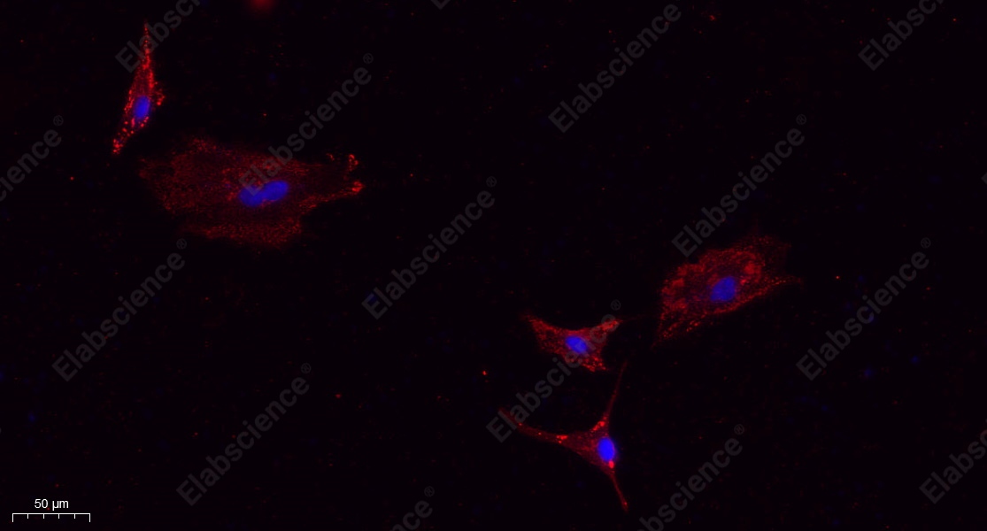 Recombinant IL-10 Monoclonal Antibody - 3