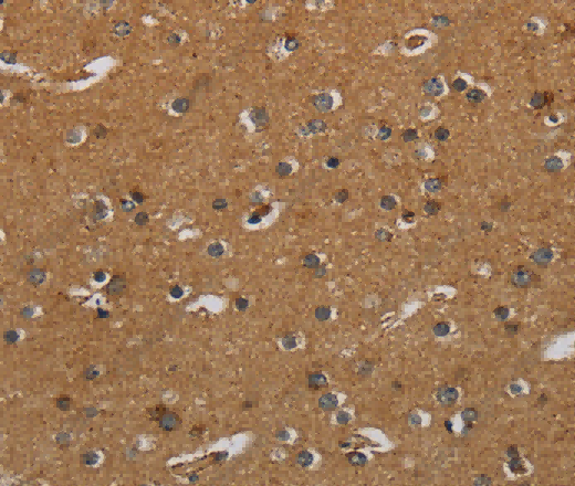 HSD17B2 Polyclonal Antibody - 3