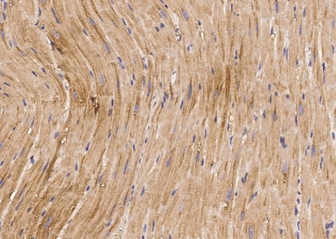 VEGF/VEGFA Monoclonal Antibody - small - 3