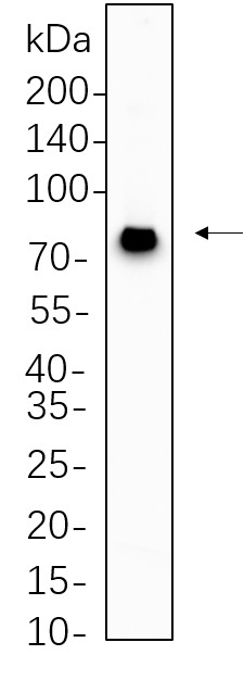 Recombinant MECP2 Monoclonal Antibody-searchlist-1