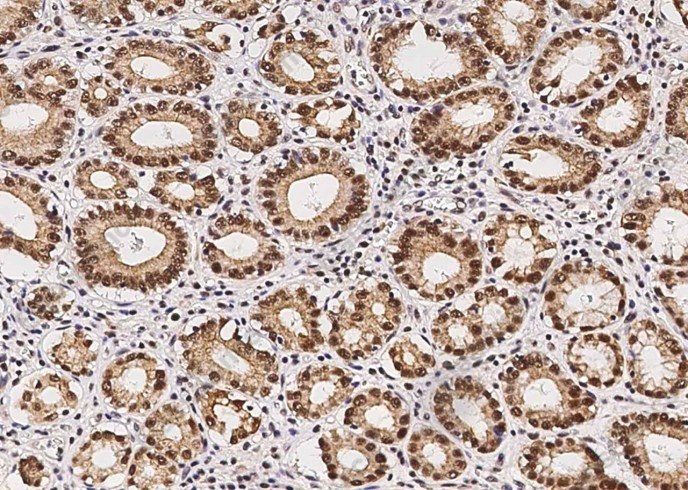 p38 alpha/MAPK14 Monoclonal Antibody - 3