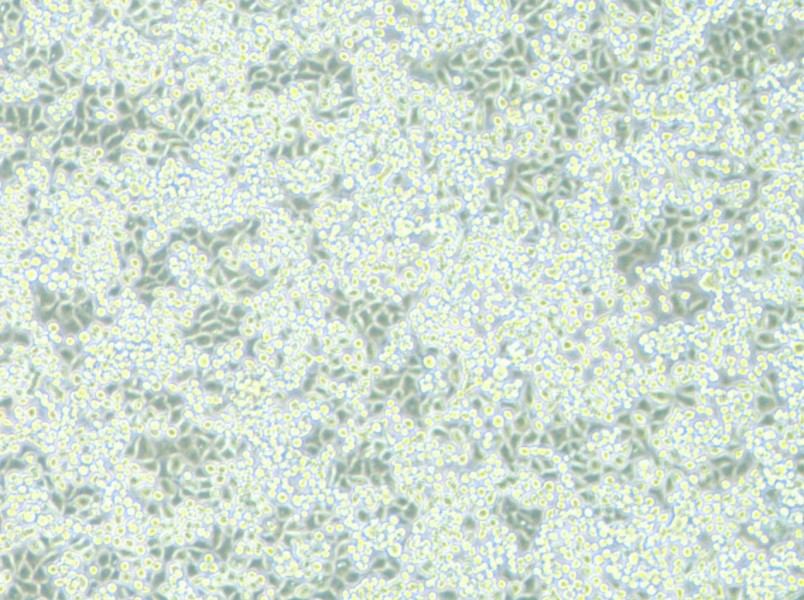 NCI-H2122 Cell Complete Medium - 9