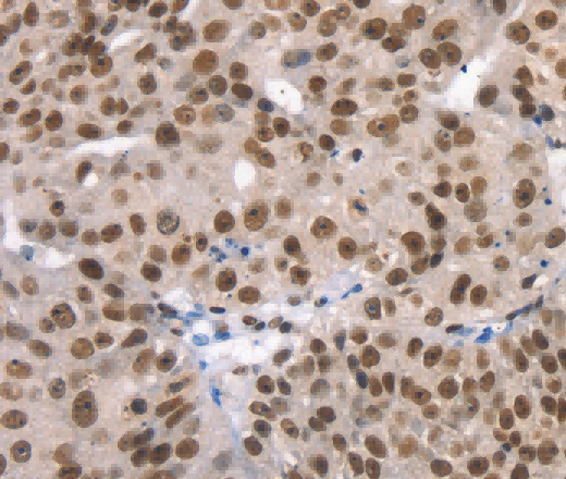 TAF15 Polyclonal Antibody - 2