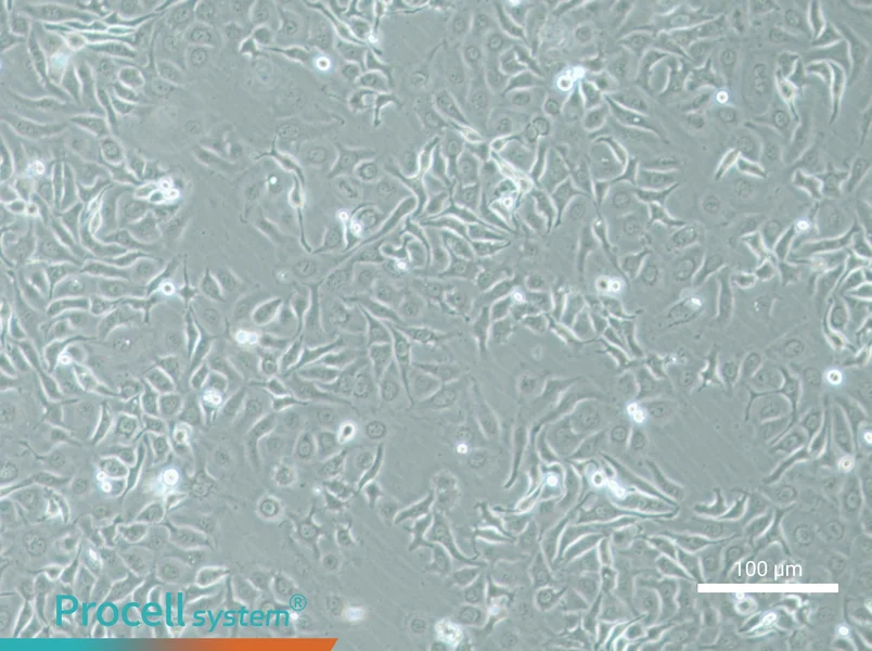 HCC1143 - 1