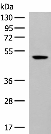 Western blot analysis of Hela cell lysate  using GPR142 Polyclonal Antibody at dilution of 1:400