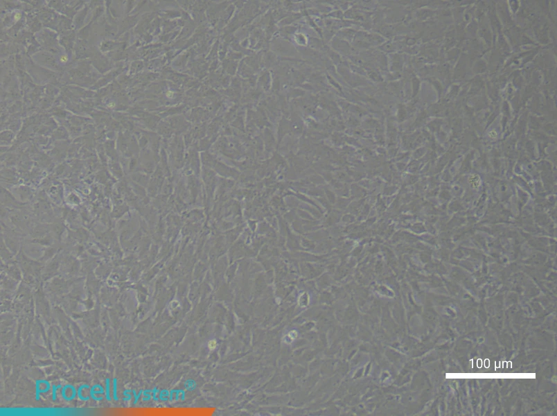 Rat Aortic Adventitial FibroblastsRat Aortic Adventitial Fibroblasts - 3