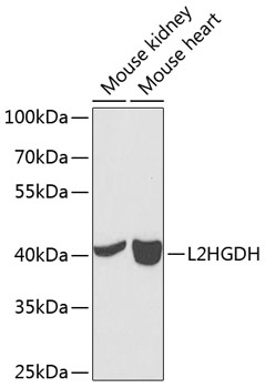 Western blot analysis of extracts of various cell lines using L2HGDH Polyclonal Antibody at 1:1000 dilution.