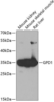 Western blot analysis of extracts of various cell lines using GPD1 Polyclonal Antibody at 1:1000 dilution.