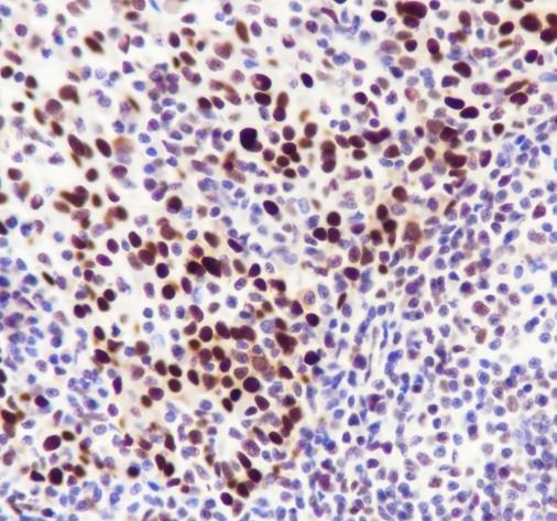 Recombinant DDB2 Monoclonal Antibody - small - 4