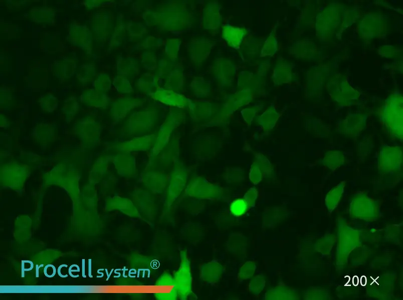 B16-F10-GFP - 5