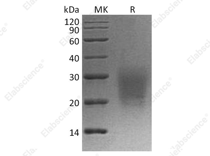 Recombinant Cynomolgus CD3d/CD3 delta Protein (His Tag) - 1