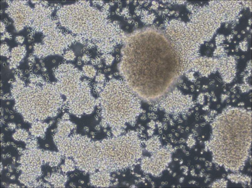 NCI-BL2009 Cell Complete Medium-searchlist-1