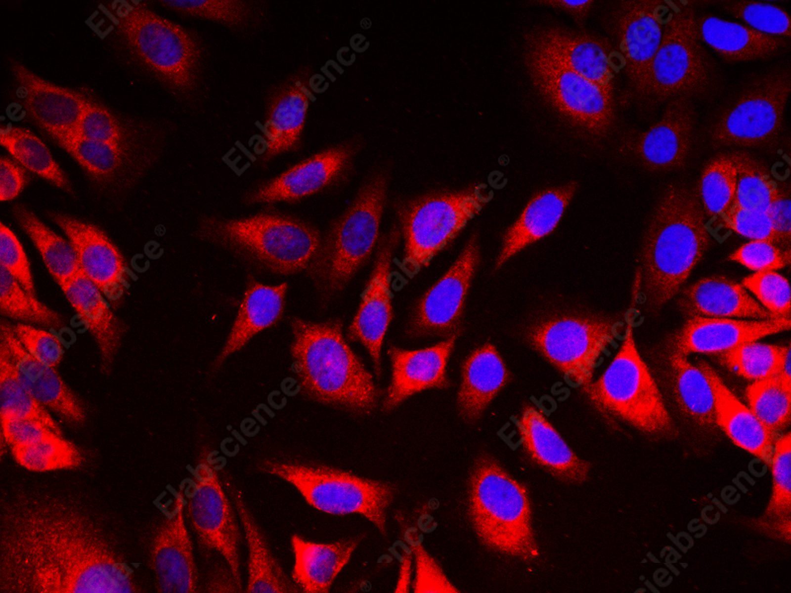 EEF2 Polyclonal Antibody - 7