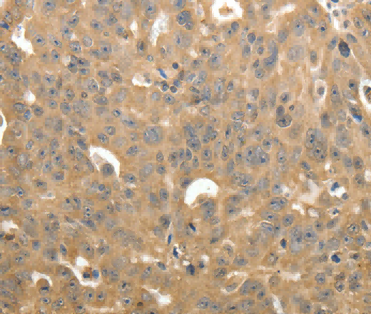 STX1A Polyclonal Antibody - 2
