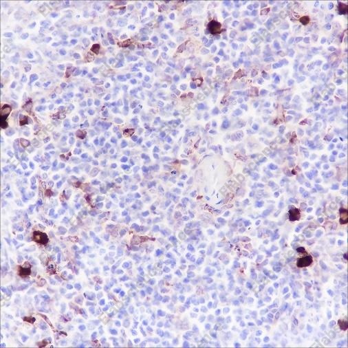 Recombinant Phospho-S6 Ribosomal Protein (Ser240, 244) Monoclonal Antibody - 4