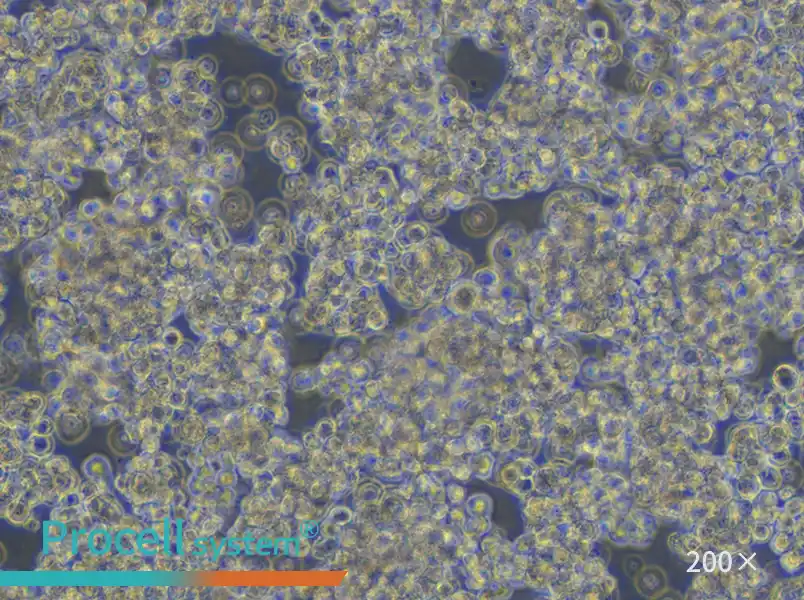 HuT 78 Cell Complete Medium - small - 4