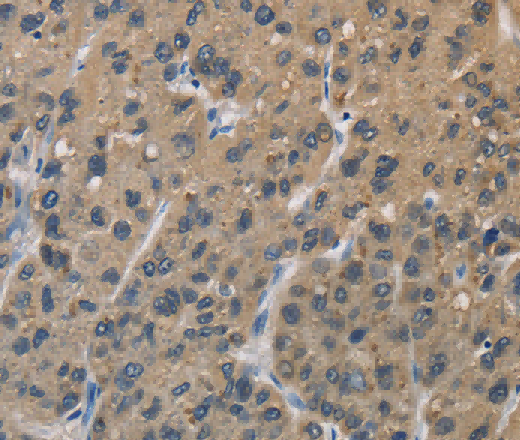 SIGMAR1 Polyclonal Antibody - 3