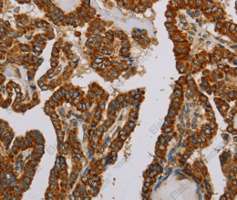NDUFS5 Polyclonal Antibody - 2