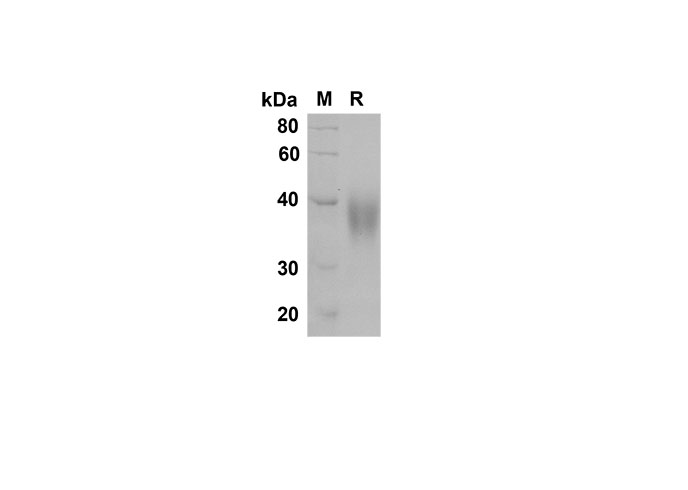 Recombinant Rat Fcγ RIIB/CD32b Protein(His Tag)-1