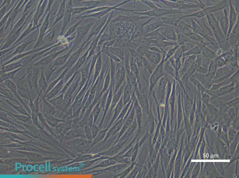 Human Pulmonary Artery Fibroblast Complete Medium - 6