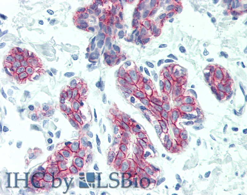 Immunohistochemistry of paraffin-embedded Breast tissue using DSG2 Polyclonal Antibody at dilution of 1:60(Elabscience Product Detected by Lifespan).