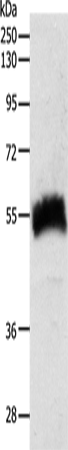 Western Blot analysis of Human fetal kidney tissue using SLC22A6 Polyclonal Antibody at dilution of 1:600