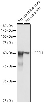 Western blot analysis of extracts of various cell lines using PRPH Polyclonal Antibody at 1:500 dilution.