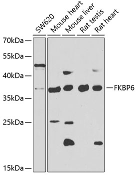 Western blot analysis of extracts of various cell lines using FKBP6 Polyclonal Antibody at 1:1000 dilution.