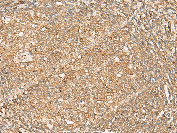 Immunohistochemistry of paraffin-embedded Human tonsil tissue  using FNTB Polyclonal Antibody at dilution of 1:35(?200)