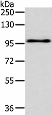 Western blot analysis of Hela cell  using EPHA3 Polyclonal Antibody at dilution of 1:400