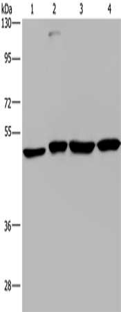 Western Blot analysis of A431, HepG2, Raji and K562 cell using CCR6 Polyclonal Antibody at dilution of 1:966