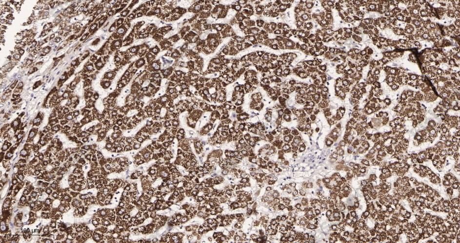 Recombinant Cathepsin D Monoclonal Antibody - 2