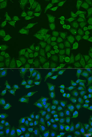 Immunofluorescence analysis of U2OS cells using PLA2G4C Polyclonal Antibody at dilution of 1:100. Blue: DAPI for nuclear staining.