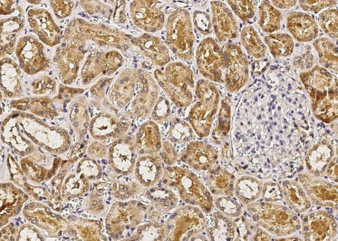 Recombinant IL-1RA/IL1RN Monoclonal Antibody - small - 2