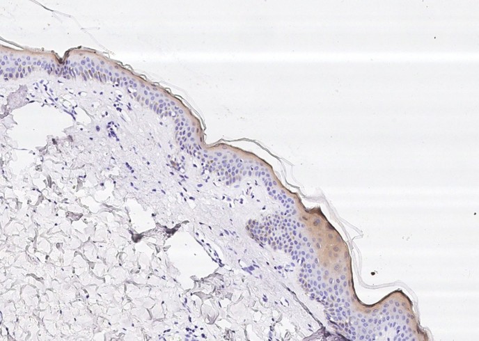 Cystatin A/CSTA Monoclonal Antibody - small - 2