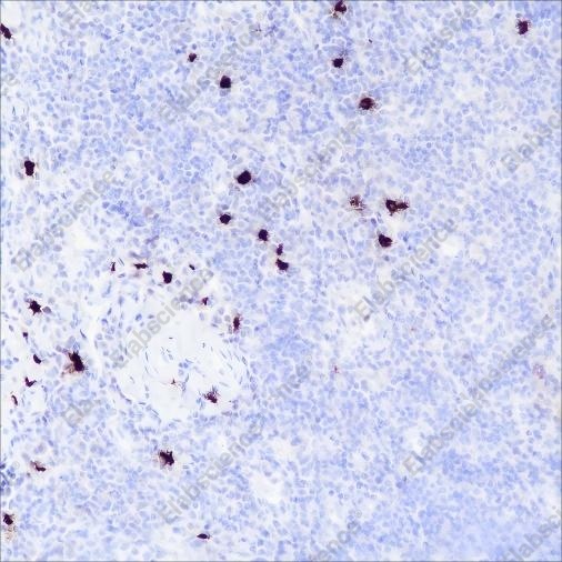 Recombinant TPSAB1 Monoclonal Antibody - 1