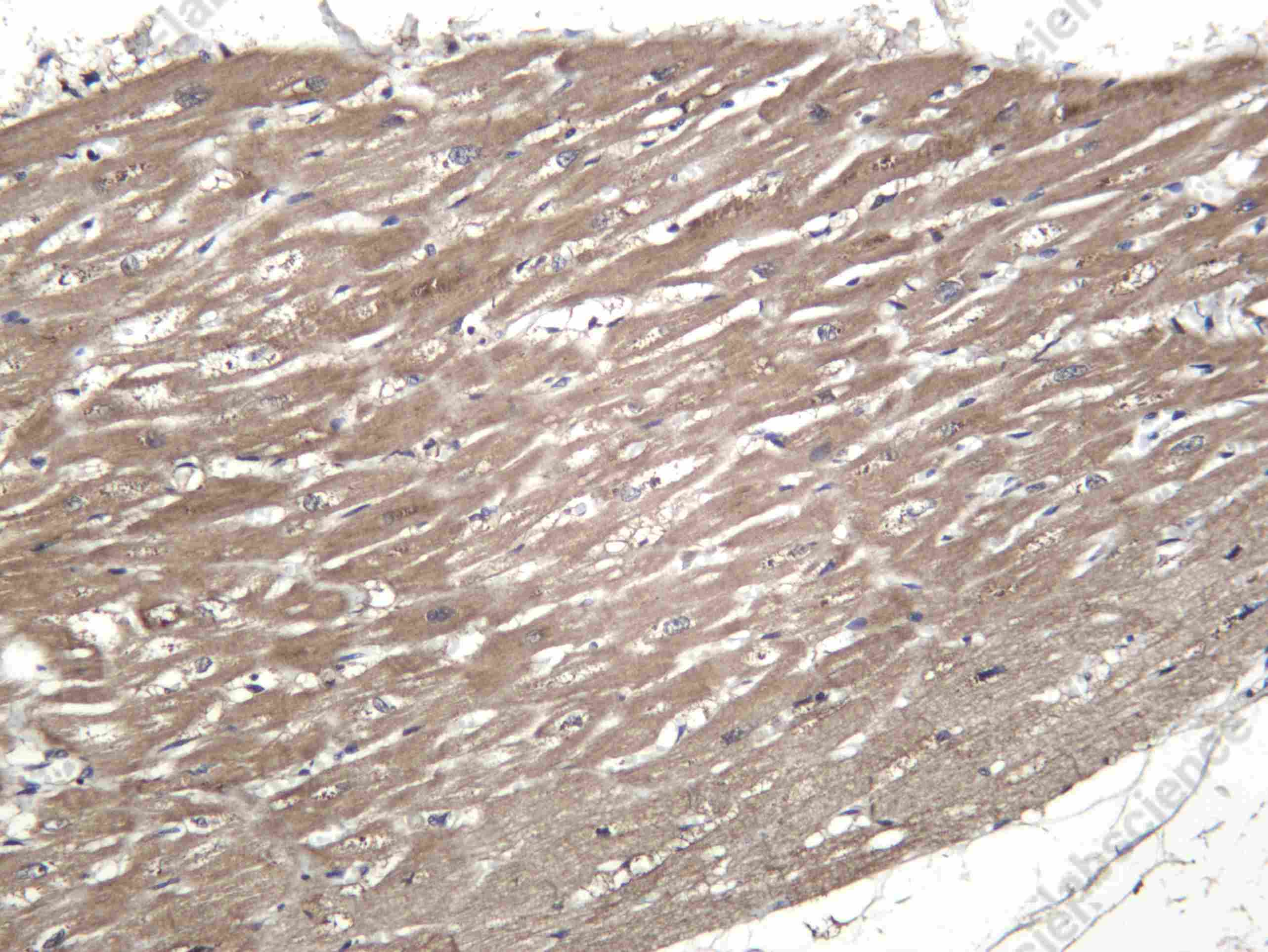 Recombinant RAB4A Monoclonal Antibody - 1