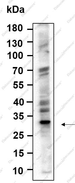 Recombinant ALKBH2 Monoclonal Antibody - 1