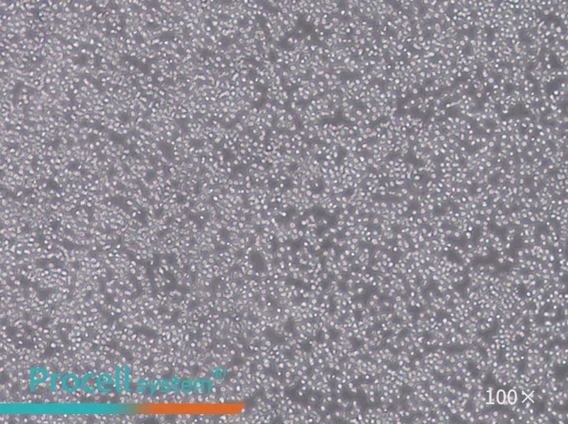 MOLT-4 Cell Complete Medium - 1