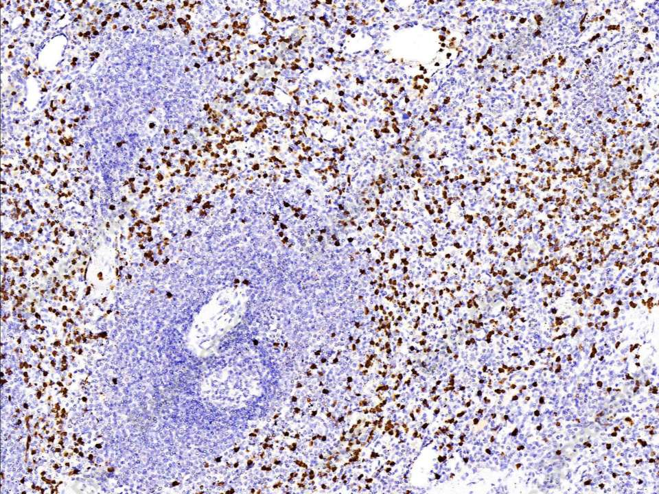 Recombinant S100A12 Monoclonal Antibody - 1