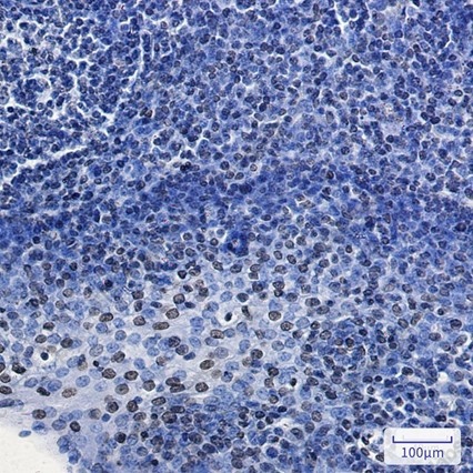 Recombinant HMGA1 Monoclonal Antibody - 2
