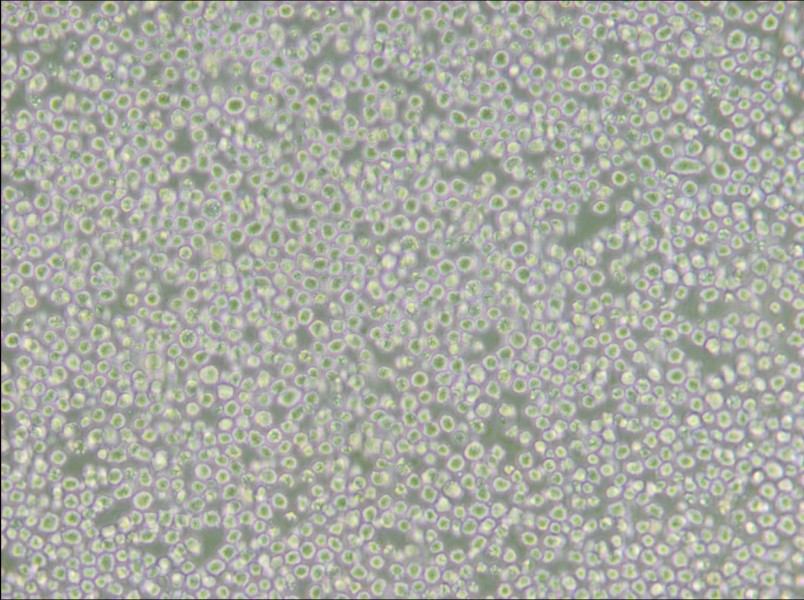 AE-1 Cell Complete Medium - 5